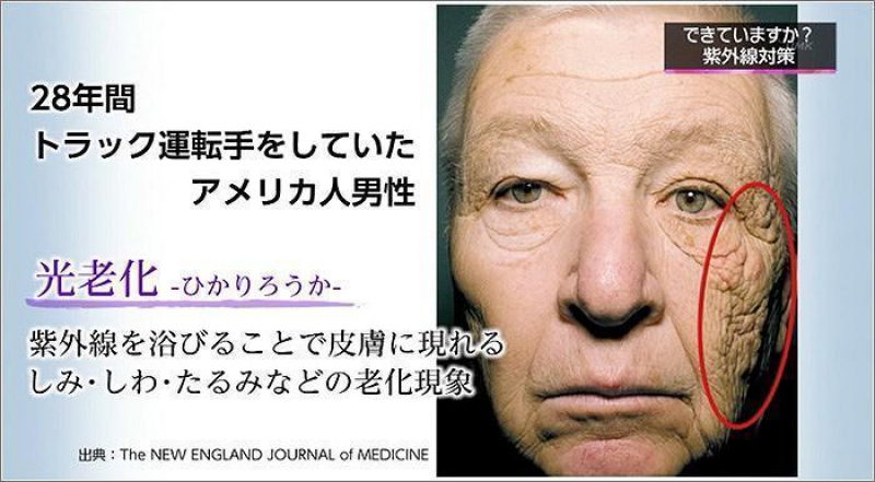 紫外線ケア　やらないと肌も毛髪もボロボロに...　　UVA・UVB